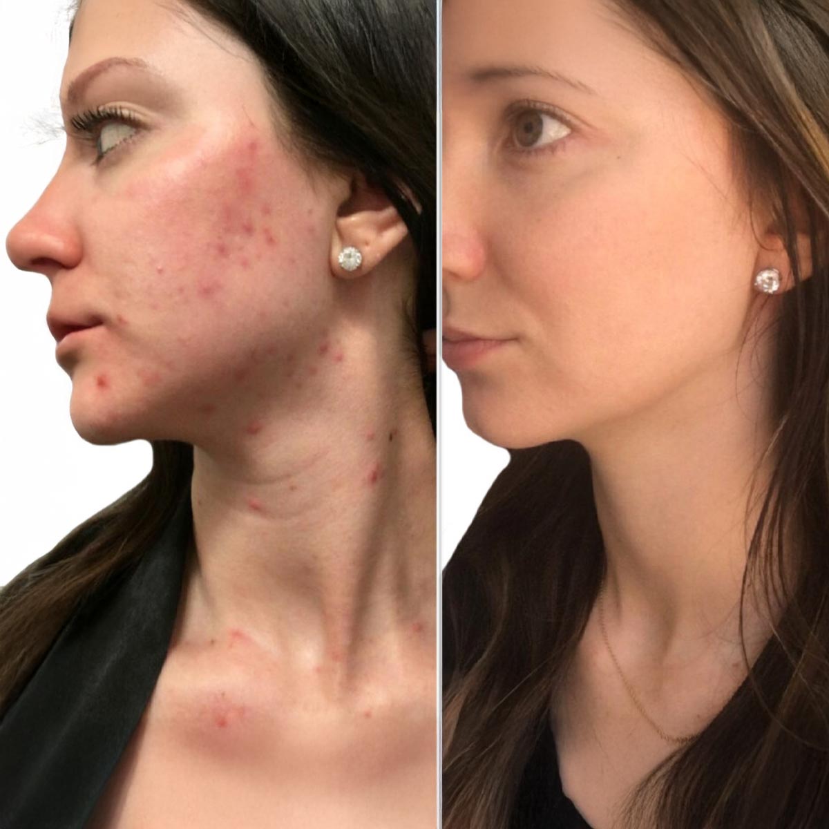 B&A10