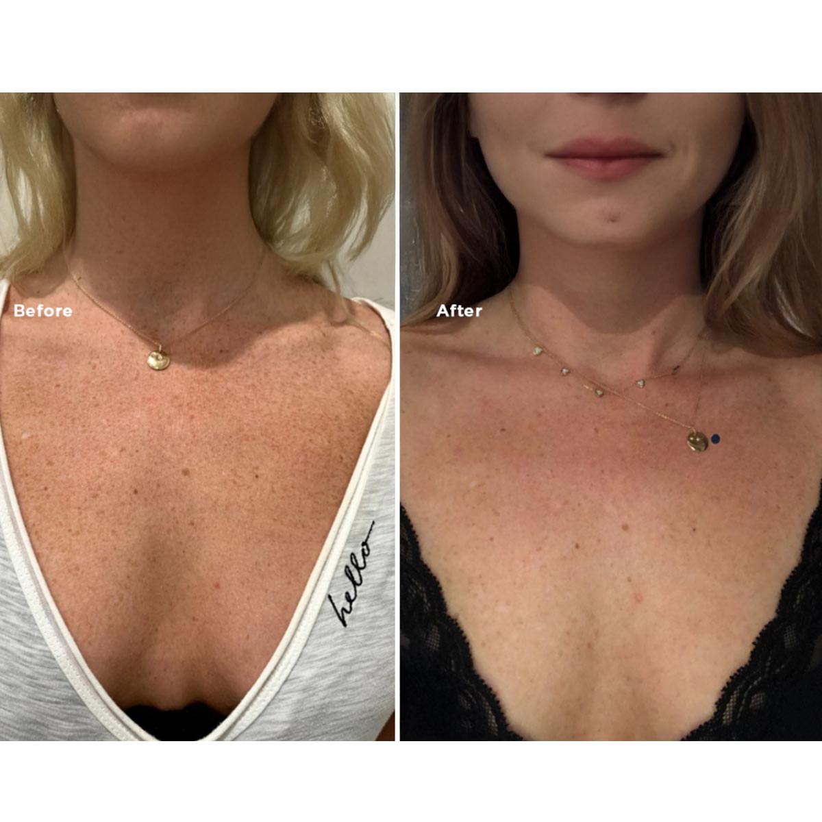 B&A13