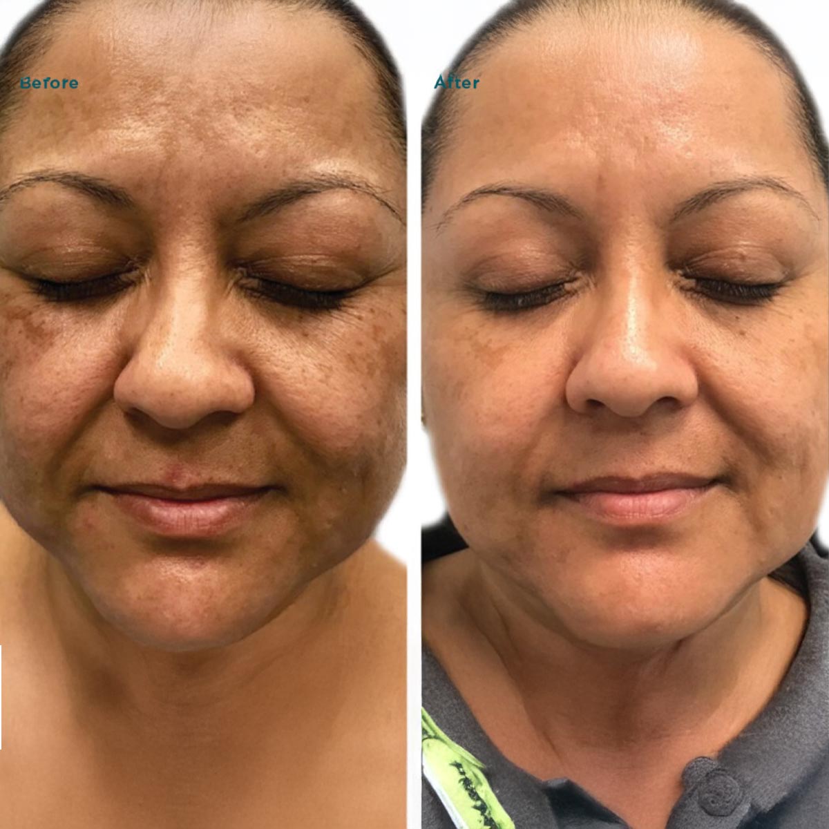 B&A14
