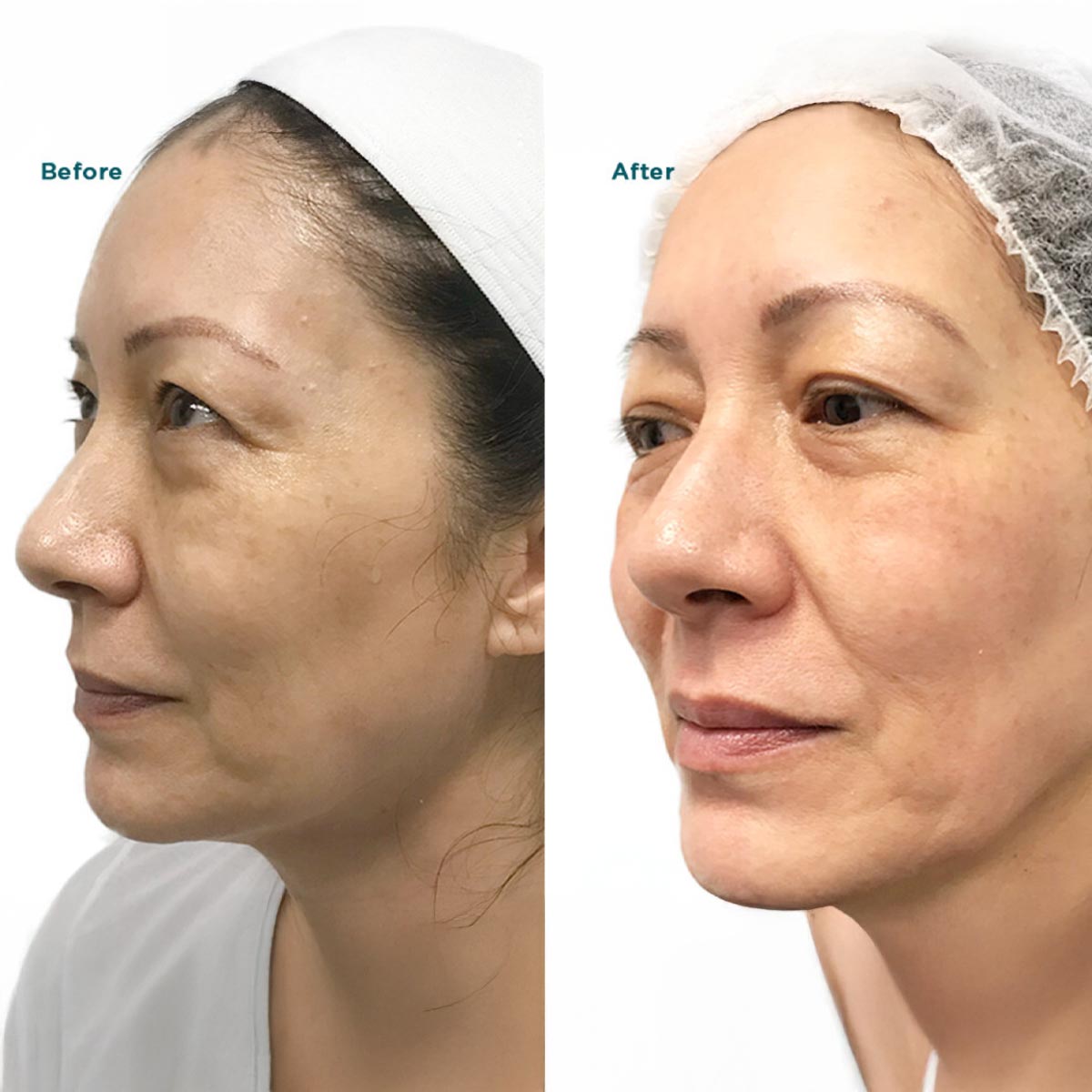 B&A6