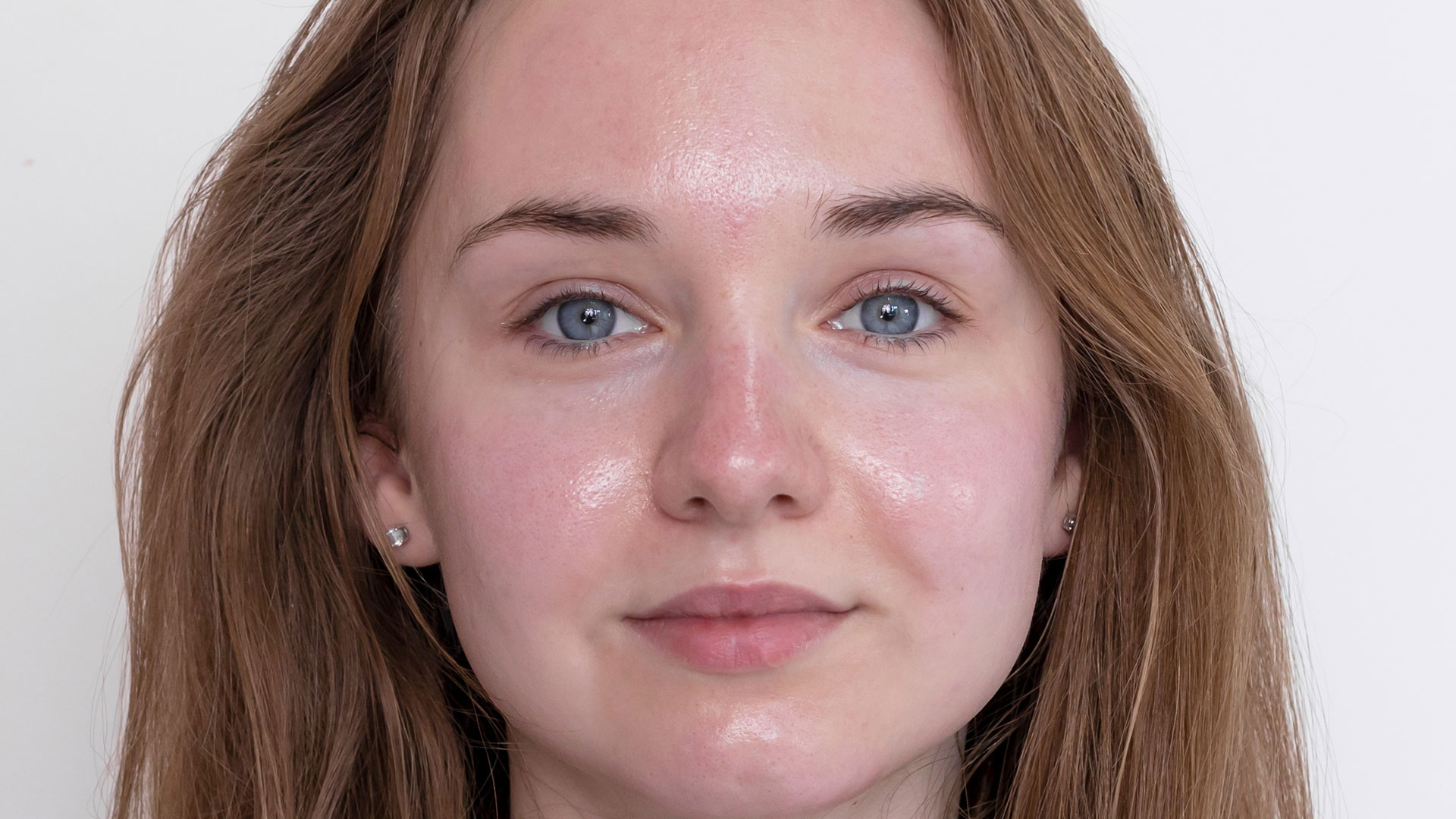 woman face wrinkles before and after treatment woman face wrinkles before and after treatment